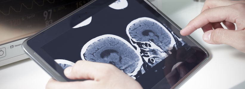 Neuroprogressive and Dementia Network part of global MSA study success as one of four UK sites